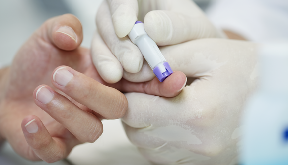 Check-ups Check-ups